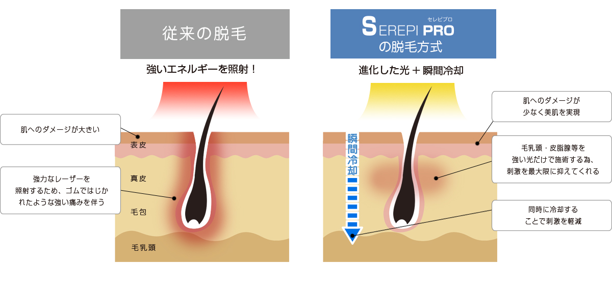 進化した光、瞬間冷却